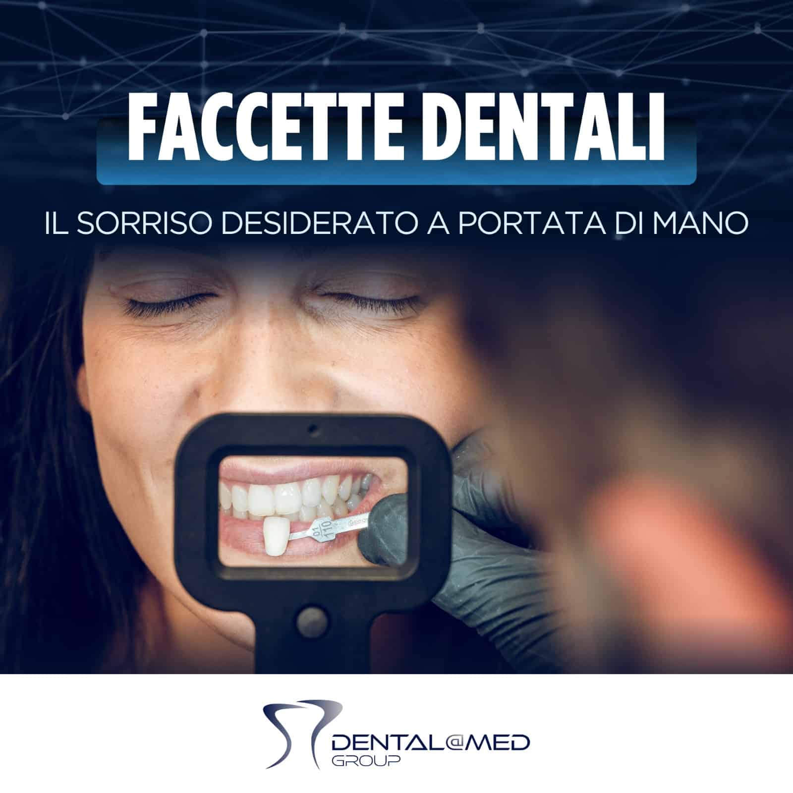 Pubblicità di Faccette Dentali che mostra un primo piano di un intervento odontoiatrico in corso.