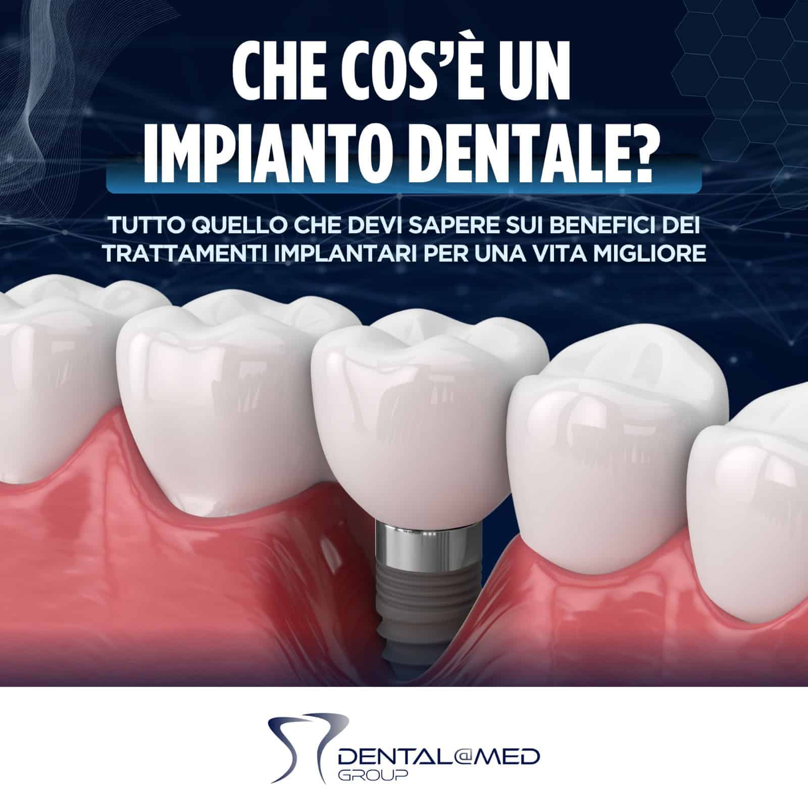 Immagine promozionale per il gruppo dental@med, contenente una grafica dettagliata di un impianto dentale nelle gengive con testo in italiano che parla dei vantaggi degli impianti dentali.